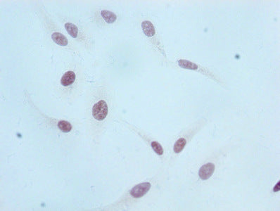 Immunocytochemistry analysis of RAC07088 diluted at 1:100 and staining in Hela cells performed on a Leica BondTM system. After dewaxing and hydration, antigen retrieval was mediated by high pressure in a citrate buffer (pH 6.0). Section was blocked with 10% normal goat serum 30min at RT. Then primary antibody (1% BSA) was incubated at 4? overnight. The primary is detected by a biotinylated secondary antibody and visualized using an HRP conjugated SP system.