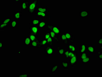 Immunofluorescence staining of Hela cells with RAC07088 at 1:37.5,counter-stained with DAPI. The cells were fixed in 4% formaldehyde, permeabilized using 0.2% Triton X-100 and blocked in 10% normal Goat Serum. The cells were then incubated with the antibody overnight at 4?.The secondary antibody was Alexa Fluor 488-congugated AffiniPure Goat Anti-Rabbit IgG (H+L).