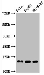 Western Blot; Positive WB detected in Hela whole cell lysate epG2 whole cell lysate H-SY5Y whole cell lysate; All lanes Mono-methyl-Histone H3.1(R2)antibody at 0.95ug/ml; Secondary; Goat polyclonal to rabbit IgG at 1/50000 dilution; Predicted band size: 15 KDa; Observed band size: 15 KDa