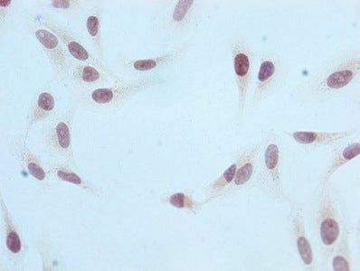 Immunocytochemistry analysis of RAC07089 diluted at 1:100 and staining in Hela cells performed on a Leica BondTM system. After dewaxing and hydration, antigen retrieval was mediated by high pressure in a citrate buffer (pH 6.0). Section was blocked with 10% normal goat serum 30min at RT. Then primary antibody (1% BSA) was incubated at 4? overnight. The primary is detected by a biotinylated secondary antibody and visualized using an HRP conjugated SP system.