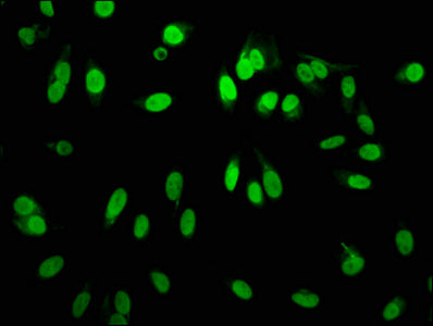 Immunofluorescence staining of Hela cells with RAC07089 at 1:60,counter-stained with DAPI. The cells were fixed in 4% formaldehyde, permeabilized using 0.2% Triton X-100 and blocked in 10% normal Goat Serum. The cells were then incubated with the antibody overnight at 4?.The secondary antibody was Alexa Fluor 488-congugated AffiniPure Goat Anti-Rabbit IgG (H+L).
