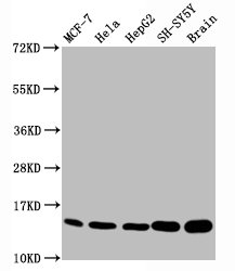 Western Blot; Positive WB detected in MCF-7 whole cell lysate ela whole cell lysate epG2 whole cell lysate H-SY5Y whole cell lysate,Rat brain tissue; All lanes Mono-methyl-Histone H3.1(K18)antibody at 0.7ug/ml; Secondary; Goat polyclonal to rabbit IgG at 1/50000 dilution; Predicted band size: 15 KDa; Observed band size: 15 KDa