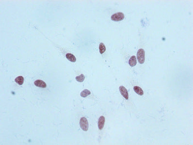 Immunocytochemistry analysis of RAC07091 diluted at 1:100 and staining in Hela cells performed on a Leica BondTM system. After dewaxing and hydration, antigen retrieval was mediated by high pressure in a citrate buffer (pH 6.0). Section was blocked with 10% normal goat serum 30min at RT. Then primary antibody (1% BSA) was incubated at 4? overnight. The primary is detected by a biotinylated secondary antibody and visualized using an HRP conjugated SP system.