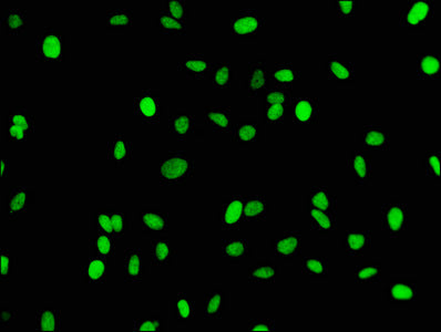 Immunofluorescence staining of Hela cells with RAC07091 at 1:43,counter-stained with DAPI. The cells were fixed in 4% formaldehyde, permeabilized using 0.2% Triton X-100 and blocked in 10% normal Goat Serum. The cells were then incubated with the antibody overnight at 4?.The secondary antibody was Alexa Fluor 488-congugated AffiniPure Goat Anti-Rabbit IgG (H+L).