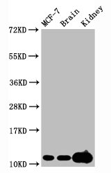 Western Blot; Positive WB detected in MCF-7 whole cell lysate ouse brain tissue,Mouse kidney tissue; All lanes Tri-methyl-Histone H4 (K20) antibody at 2.15ug/ml; Secondary; Goat polyclonal to rabbit IgG at 1/50000 dilution; Predicted band size: 11 KDa; Observed band size: 11 KDa