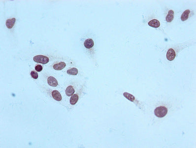 Immunocytochemistry analysis of RAC07093 diluted at 1:100 and staining in Hela cells performed on a Leica BondTM system. After dewaxing and hydration, antigen retrieval was mediated by high pressure in a citrate buffer (pH 6.0). Section was blocked with 10% normal goat serum 30min at RT. Then primary antibody (1% BSA) was incubated at 4? overnight. The primary is detected by a biotinylated secondary antibody and visualized using an HRP conjugated SP system.