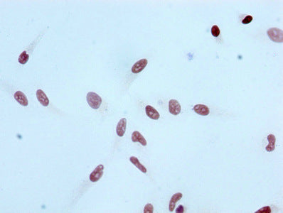 Immunocytochemistry analysis of RAC07094 diluted at 1:100 and staining in Hela cells performed on a Leica BondTM system. After dewaxing and hydration, antigen retrieval was mediated by high pressure in a citrate buffer (pH 6.0). Section was blocked with 10% normal goat serum 30min at RT. Then primary antibody (1% BSA) was incubated at 4? overnight. The primary is detected by a biotinylated secondary antibody and visualized using an HRP conjugated SP system.
