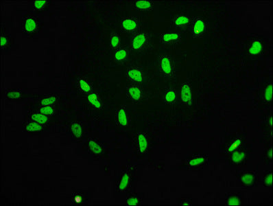 Immunofluorescence staining of Hela cells(treated by 15mM sodium butyrate for 30min) with RAC07094 at 1:68,counter-stained with DAPI. The cells were fixed in 4% formaldehyde, permeabilized using 0.2% Triton X-100 and blocked in 10% normal Goat Serum. The cells were then incubated with the antibody overnight at 4?.The secondary antibody was Alexa Fluor 488-congugated AffiniPure Goat Anti-Rabbit IgG (H+L).