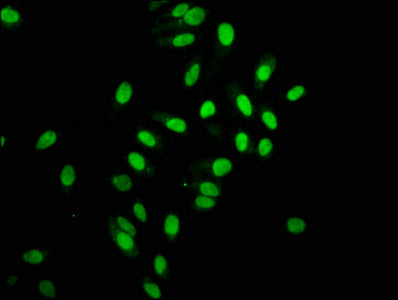 Immunofluorescence staining of Hela cells with RAC07095 at 1:168,counter-stained with DAPI. The cells were fixed in 4% formaldehyde, permeabilized using 0.2% Triton X-100 and blocked in 10% normal Goat Serum. The cells were then incubated with the antibody overnight at 4?.The secondary antibody was Alexa Fluor 488-congugated AffiniPure Goat Anti-Rabbit IgG (H+L).
