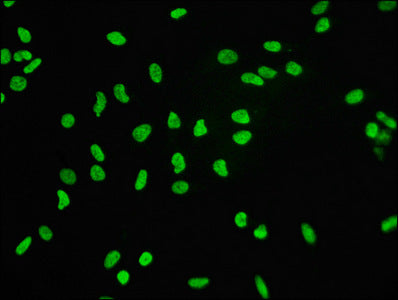 Immunofluorescence staining of Hela cells with RAC07096 at 1:60,counter-stained with DAPI. The cells were fixed in 4% formaldehyde, permeabilized using 0.2% Triton X-100 and blocked in 10% normal Goat Serum. The cells were then incubated with the antibody overnight at 4?.The secondary antibody was Alexa Fluor 488-congugated AffiniPure Goat Anti-Rabbit IgG (H+L).