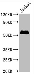 Western Blot; Positive WB detected in Jurkat whole cell lysate; All lanes CD4 antibody at 0.8ug/ml; Secondary; Goat polyclonal to rabbit IgG at 1/50000 dilution; Predicted band size: 55 KDa; Observed band size: 55 Kda
