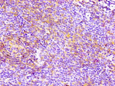 IHC image of RAC07098 diluted at 1:100 and staining in paraffin-embedded human lymph node tissue performed on a Leica BondTM system. After dewaxing and hydration, antigen retrieval was mediated by high pressure in a citrate buffer (pH 6.0). Section was blocked with 10% normal goat serum 30min at RT. Then primary antibody (1% BSA) was incubated at 4? overnight. The primary is detected by a biotinylated secondary antibody and visualized using an HRP conjugated SP system.