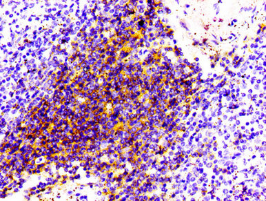 IHC image of RAC07098 diluted at 1:100 and staining in paraffin-embedded human spleen tissue performed on a Leica BondTM system. After dewaxing and hydration, antigen retrieval was mediated by high pressure in a citrate buffer (pH 6.0). Section was blocked with 10% normal goat serum 30min at RT. Then primary antibody (1% BSA) was incubated at 4? overnight. The primary is detected by a biotinylated secondary antibody and visualized using an HRP conjugated SP system.
