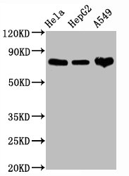 Western Blot; Positive WB detected in Hela whole cell lysate,HepG2 whole cell lysate,A549 whole cell lysate; All lanes CD44 antibody at 1.25ug/ml; Secondary; Goat polyclonal to rabbit IgG at 1/50000 dilution; Predicted band size: 82 KDa; Observed band size: 82 KDa