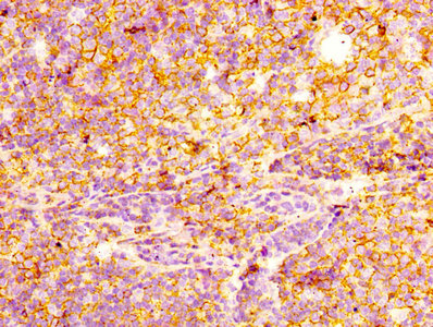 IHC image of RAC07100 diluted at 1:100 and staining in paraffin-embedded human tonsil tissue performed on a Leica BondTM system. After dewaxing and hydration, antigen retrieval was mediated by high pressure in a citrate buffer (pH 6.0). Section was blocked with 10% normal goat serum 30min at RT. Then primary antibody (1% BSA) was incubated at 4? overnight. The primary is detected by a biotinylated secondary antibody and visualized using an HRP conjugated SP system.