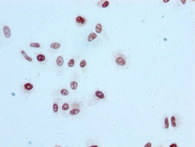 Immunocytochemistry analysis of RAC07101 diluted at 1:100 and staining in HepG2 cells performed on a Leica BondTM system. After dewaxing and hydration, antigen retrieval was mediated by high pressure in a citrate buffer (pH 6.0). Section was blocked with 10% normal goat serum 30min at RT. Then primary antibody (1% BSA) was incubated at 4? overnight. The primary is detected by a biotinylated secondary antibody and visualized using an HRP conjugated SP system.