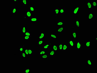 Immunofluorescence staining of Hela cells(treated by 15mM sodium butyrate for 30min) with RAC07101 at 1:43,counter-stained with DAPI. The cells were fixed in 4% formaldehyde, permeabilized using 0.2% Triton X-100 and blocked in 10% normal Goat Serum. The cells were then incubated with the antibody overnight at 4?.The secondary antibody was Alexa Fluor 488-congugated AffiniPure Goat Anti-Rabbit IgG (H+L).
