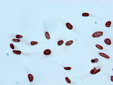 Immunocytochemistry analysis of RAC07103 diluted at 1:100 and staining in Hela cells performed on a Leica BondTM system. After dewaxing and hydration, antigen retrieval was mediated by high pressure in a citrate buffer (pH 6.0). Section was blocked with 10% normal goat serum 30min at RT. Then primary antibody (1% BSA) was incubated at 4? overnight. The primary is detected by a biotinylated secondary antibody and visualized using an HRP conjugated SP system.