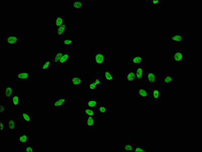 Immunofluorescence staining of Hela cells(treated by 15mM sodium butyrate for 30min) with RAC07103 at 1:84,counter-stained with DAPI. The cells were fixed in 4% formaldehyde, permeabilized using 0.2% Triton X-100 and blocked in 10% normal Goat Serum. The cells were then incubated with the antibody overnight at 4?.The secondary antibody was Alexa Fluor 488-congugated AffiniPure Goat Anti-Rabbit IgG (H+L).