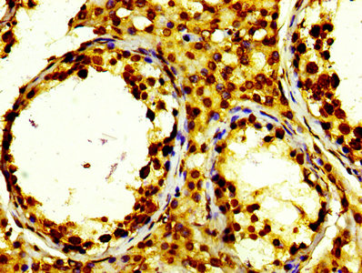 IHC image of RAC07104 diluted at 1:100 and staining in paraffin-embedded human testis tissue performed on a Leica BondTM system. After dewaxing and hydration, antigen retrieval was mediated by high pressure in a citrate buffer (pH 6.0). Section was blocked with 10% normal goat serum 30min at RT. Then primary antibody (1% BSA) was incubated at 4? overnight. The primary is detected by a biotinylated secondary antibody and visualized using an HRP conjugated SP system.