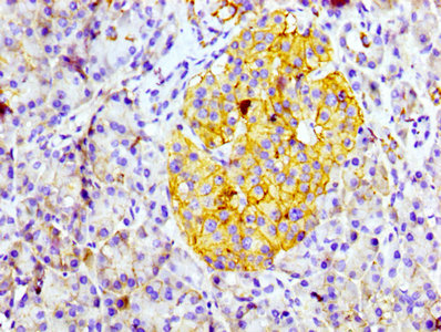IHC image of RAC07107 diluted at 1:100 and staining in paraffin-embedded human pancreatic tissue performed on a Leica BondTM system. After dewaxing and hydration, antigen retrieval was mediated by high pressure in a citrate buffer (pH 6.0). Section was blocked with 10% normal goat serum 30min at RT. Then primary antibody (1% BSA) was incubated at 4? overnight. The primary is detected by a biotinylated secondary antibody and visualized using an HRP conjugated SP system.