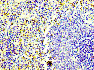 IHC image of RAC07109 diluted at 1:100 and staining in paraffin-embedded human spleen tissue performed on a Leica BondTM system. After dewaxing and hydration, antigen retrieval was mediated by high pressure in a citrate buffer (pH 6.0). Section was blocked with 10% normal goat serum 30min at RT. Then primary antibody (1% BSA) was incubated at 4? overnight. The primary is detected by a biotinylated secondary antibody and visualized using an HRP conjugated SP system.