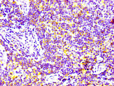 IHC image of RAC07110 diluted at 1:100 and staining in paraffin-embedded human lymph node tissue performed on a Leica BondTM system. After dewaxing and hydration, antigen retrieval was mediated by high pressure in a citrate buffer (pH 6.0). Section was blocked with 10% normal goat serum 30min at RT. Then primary antibody (1% BSA) was incubated at 4? overnight. The primary is detected by a biotinylated secondary antibody and visualized using an HRP conjugated SP system.