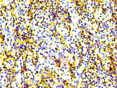 IHC image of RAC07110 diluted at 1:100 and staining in paraffin-embedded human spleen tissue performed on a Leica BondTM system. After dewaxing and hydration, antigen retrieval was mediated by high pressure in a citrate buffer (pH 6.0). Section was blocked with 10% normal goat serum 30min at RT. Then primary antibody (1% BSA) was incubated at 4? overnight. The primary is detected by a biotinylated secondary antibody and visualized using an HRP conjugated SP system.