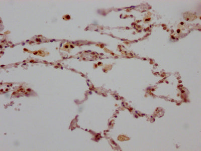 IHC image of RAC07112 diluted at 1:100 and staining in paraffin-embedded human lung tissue performed on a Leica BondTM system. After dewaxing and hydration, antigen retrieval was mediated by high pressure in a citrate buffer (pH 6.0). Section was blocked with 10% normal goat serum 30min at RT. Then primary antibody (1% BSA) was incubated at 4? overnight. The primary is detected by a Goat anti-rabbit IgG polymer labeled by HRP and visualized using 0.05% DAB.