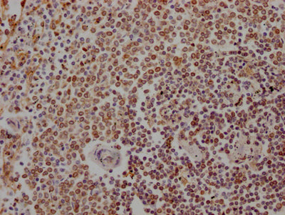 IHC image of RAC07112 diluted at 1:100 and staining in paraffin-embedded human spleen tissue performed on a Leica BondTM system. After dewaxing and hydration, antigen retrieval was mediated by high pressure in a citrate buffer (pH 6.0). Section was blocked with 10% normal goat serum 30min at RT. Then primary antibody (1% BSA) was incubated at 4? overnight. The primary is detected by a Goat anti-rabbit IgG polymer labeled by HRP and visualized using 0.05% DAB.