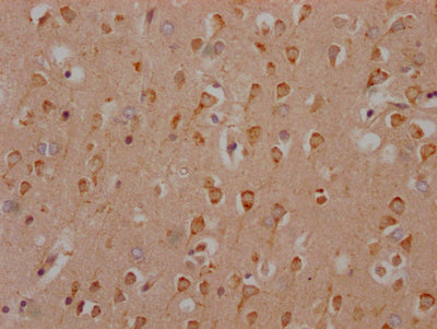IHC image of RAC07113 diluted at 1:100 and staining in paraffin-embedded human brain tissue performed on a Leica BondTM system. After dewaxing and hydration, antigen retrieval was mediated by high pressure in a citrate buffer (pH 6.0). Section was blocked with 10% normal goat serum 30min at RT. Then primary antibody (1% BSA) was incubated at 4? overnight. The primary is detected by a Goat anti-rabbit IgG polymer labeled by HRP and visualized using 0.05% DAB.