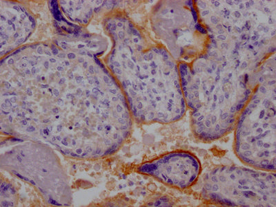 IHC image of RAC07114 diluted at 1:100 and staining in paraffin-embedded human placenta tissue performed on a Leica BondTM system. After dewaxing and hydration, antigen retrieval was mediated by high pressure in a citrate buffer (pH 6.0). Section was blocked with 10% normal goat serum 30min at RT. Then primary antibody (1% BSA) was incubated at 4? overnight. The primary is detected by a Goat anti-rabbit IgG polymer labeled by HRP and visualized using 0.05% DAB.