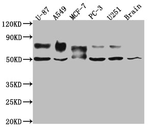 Western Blot; Positive WB detected in: U-87 whole cell lysate, A549 whole cell lysate, MCF-7 whole cell lysate, PC-3 whole cell lysate, U-251 whole cell lysate, Mouse Brain whole cell lysate; All lanes: 5T4 antibody at 1:1000; Secondary; Goat polyclonal to rabbit IgG at 1/50000 dilution; Predicted band size: 47 kDa; Observed band size: 50, 80 kDa