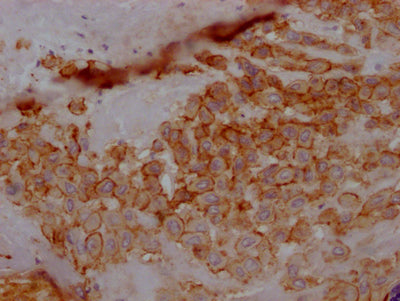 IHC image of RAC07115 diluted at 1:100 and staining in paraffin-embedded human placenta tissue performed on a Leica BondTM system. After dewaxing and hydration, antigen retrieval was mediated by high pressure in a citrate buffer (pH 6.0). Section was blocked with 10% normal goat serum 30min at RT. Then primary antibody (1% BSA) was incubated at 4? overnight. The primary is detected by a Goat anti-rabbit IgG polymer labeled by HRP and visualized using 0.05% DAB.