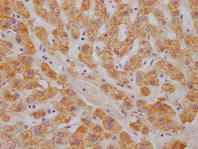 IHC image of RAC07116 diluted at 1:100 and staining in paraffin-embedded human liver tissue performed on a Leica BondTM system. After dewaxing and hydration, antigen retrieval was mediated by high pressure in a citrate buffer (pH 6.0). Section was blocked with 10% normal goat serum 30min at RT. Then primary antibody (1% BSA) was incubated at 4? overnight. The primary is detected by a Goat anti-rabbit IgG polymer labeled by HRP and visualized using 0.05% DAB.