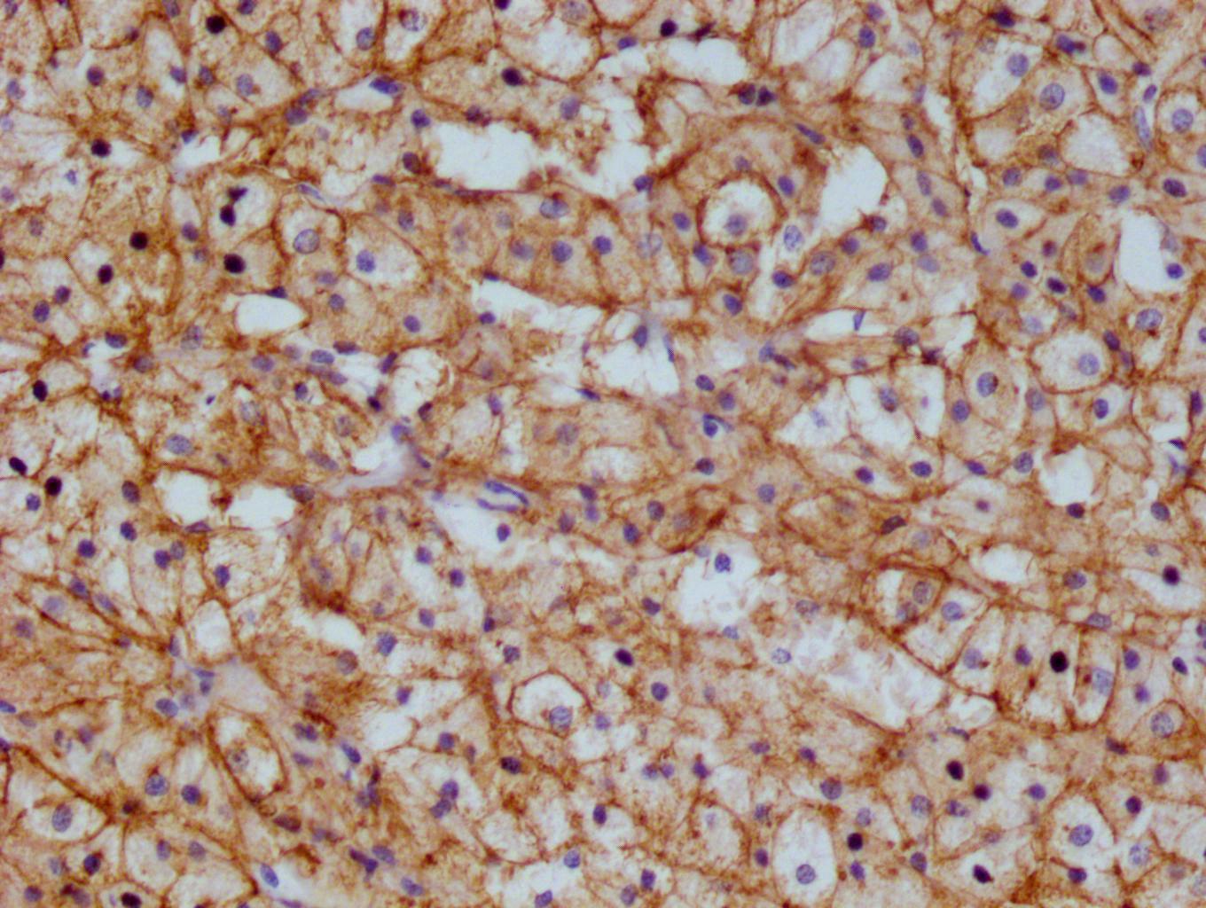 IHC image of RAC07117 diluted at 1:100 and staining in paraffin-embedded human adrenal gland tissue performed on a Leica BondTM system. After dewaxing and hydration, antigen retrieval was mediated by high pressure in a citrate buffer (pH 6.0). Section was blocked with 10% normal goat serum 30min at RT. Then primary antibody (1% BSA) was incubated at 4Â°C overnight. The primary is detected by a Goat anti-rabbit polymer IgG labeled by HRP and visualized using 0.05% DAB.