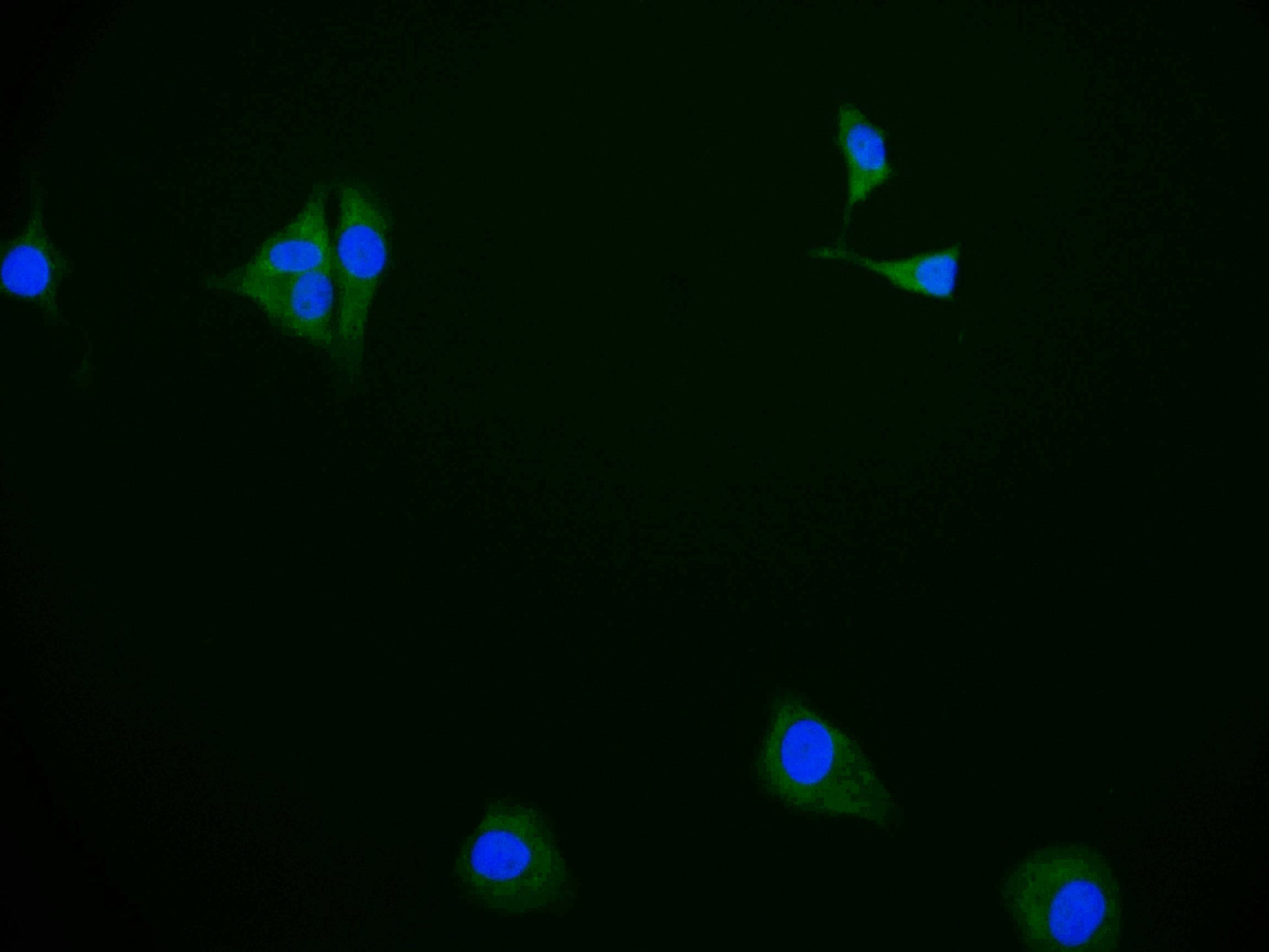 Immunofluorescence staining of HepG2 cell with RAC07117 at 1:50, counter-stained with DAPI. The cells were fixed in 4% formaldehyde and blocked in 10% normal Goat Serum. The cells were then incubated with the antibody overnight at 4Â°C. The secondary antibody was Alexa Fluor 583-congugated AffiniPure Goat Anti-Rabbit IgG(H+L).