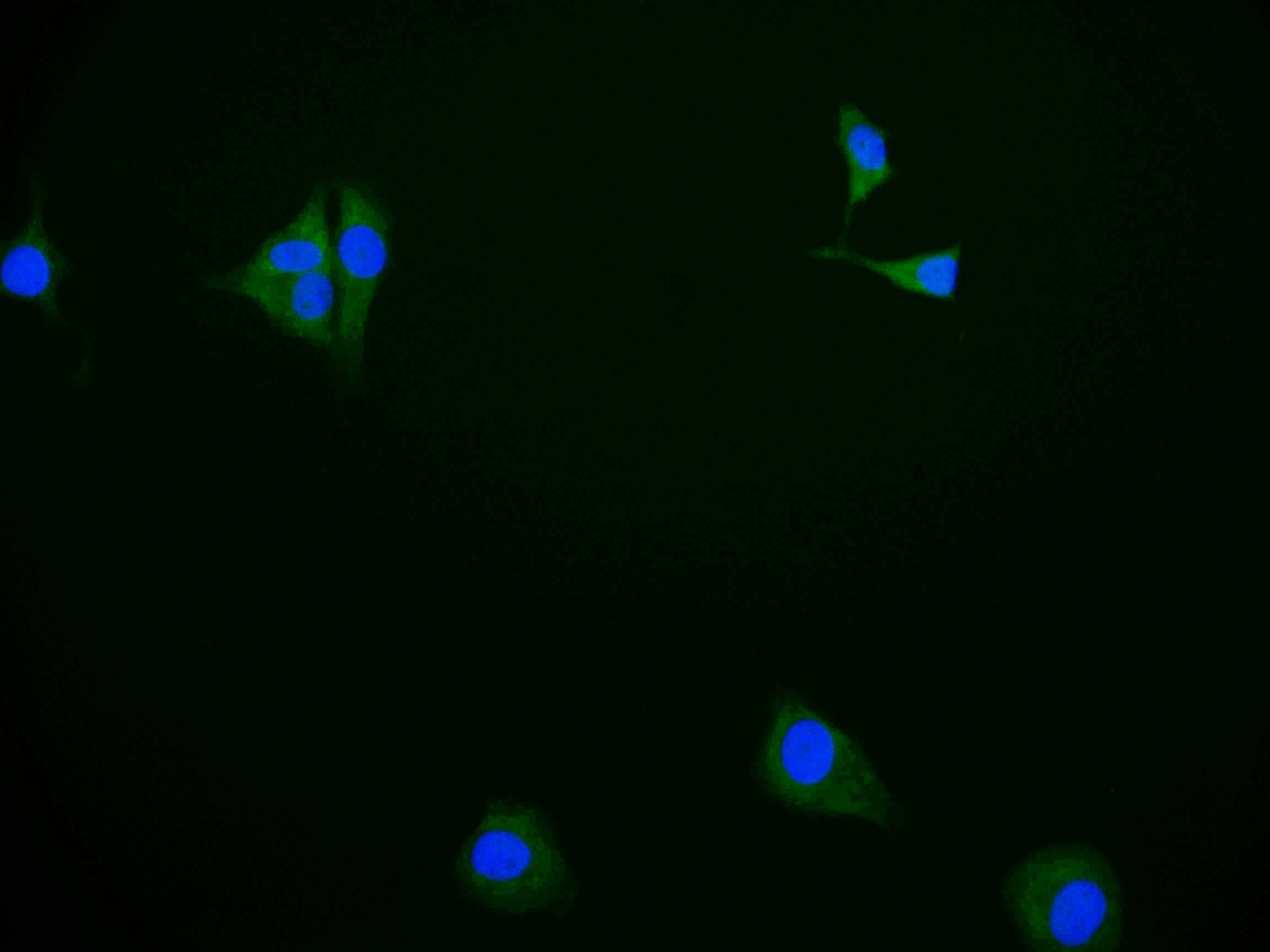 Immunofluorescence staining of HepG2 cell with RAC07117 at 1:50, counter-stained with DAPI. The cells were fixed in 4% formaldehyde and blocked in 10% normal Goat Serum. The cells were then incubated with the antibody overnight at 4Â°C. The secondary antibody was Alexa Fluor 583-congugated AffiniPure Goat Anti-Rabbit IgG(H+L).