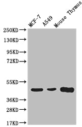 Western Blot; Positive WB detected in: MCF-7 whole cell lysate, A549 whole cell lysate, Mouse thymus; All lanes: ACAA2 antibody at 1:2000; Secondary; Goat polyclonal to rabbit IgG at 1/50000 dilution; Predicted band size: 42 kDa; Observed band size: 42 kDa