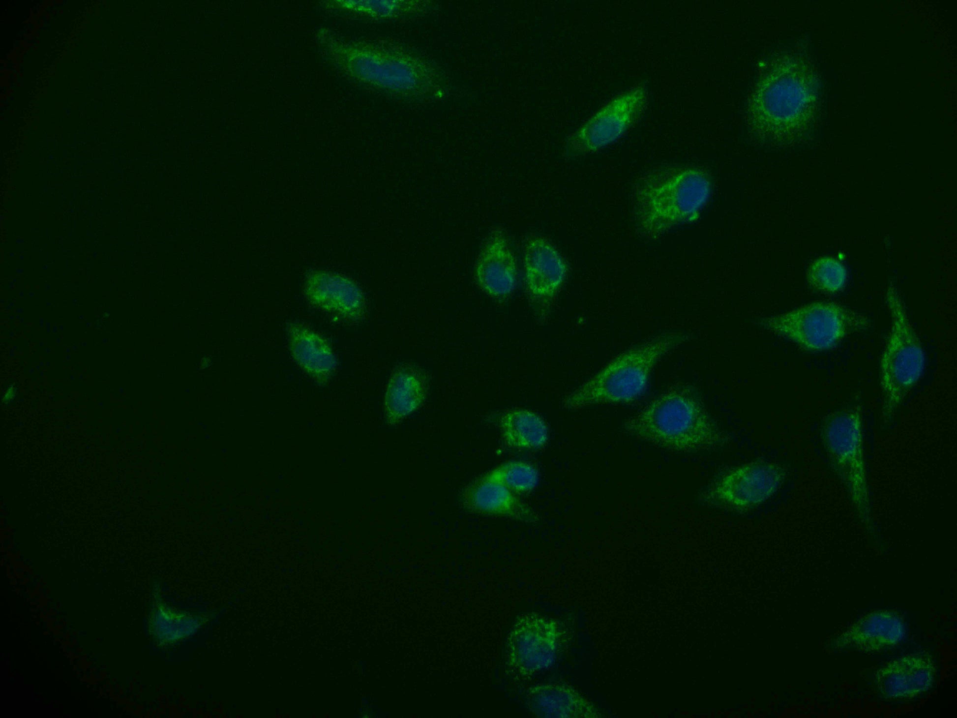 Immunofluorescence staining of Hela cell with RAC07118 at 1:50, counter-stained with DAPI. The cells were fixed in 4% formaldehyde and blocked in 10% normal Goat Serum. The cells were then incubated with the antibody overnight at 4Â°C. The secondary antibody was Alexa Fluor 570-congugated AffiniPure Goat Anti-Rabbit IgG(H+L).