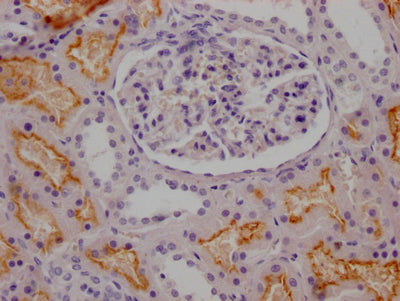 IHC image of RAC07119 diluted at 1:100 and staining in paraffin-embedded human kidney tissue performed on a Leica BondTM system. After dewaxing and hydration, antigen retrieval was mediated by high pressure in a citrate buffer (pH 6.0). Section was blocked with 10% normal goat serum 30min at RT. Then primary antibody (1% BSA) was incubated at 4? overnight. The primary is detected by a Goat anti-rabbit IgG polymer labeled by HRP and visualized using 0.05% DAB.