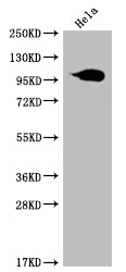 Western Blot; Positive WB detected in: Hela whole cell lysate; All lanes: ACO1 antibody at 1:2000; Secondary; Goat polyclonal to rabbit IgG at 1/50000 dilution; Predicted band size: 100 kDa; Observed band size: 95-130 kDa