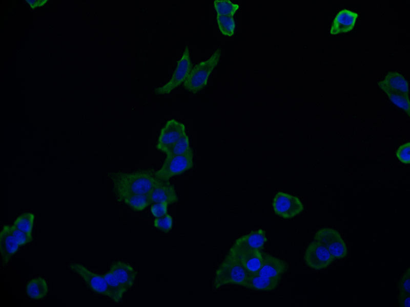 Immunofluorescence staining of HepG2 cell with RAC07120 at 1:50, counter-stained with DAPI. The cells were fixed in 4% formaldehyde and blocked in 10% normal Goat Serum. The cells were then incubated with the antibody overnight at 4Â°C. The secondary antibody was Alexa Fluor 511-congugated AffiniPure Goat Anti-Rabbit IgG(H+L).