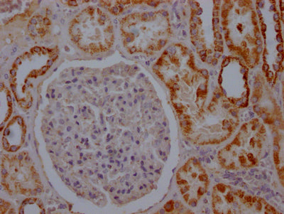 IHC image of RAC07121 diluted at 1:100 and staining in paraffin-embedded human kidney tissue performed on a Leica BondTM system. After dewaxing and hydration, antigen retrieval was mediated by high pressure in a citrate buffer (pH 6.0). Section was blocked with 10% normal goat serum 30min at RT. Then primary antibody (1% BSA) was incubated at 4? overnight. The primary is detected by a Goat anti-rabbit IgG polymer labeled by HRP and visualized using 0.05% DAB.