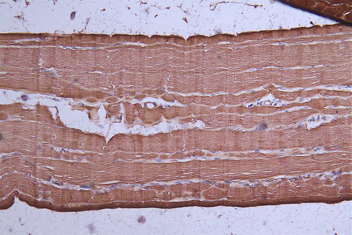 IHC image of diluted at 1:50 and staining in paraffin-embedded human skeletal muscle tissue performed on a Leica BondTM system. After dewaxing and hydration, antigen retrieval was mediated by high pressure in a citrate buffer (pH 6.0). Section was blocked with 10% normal goat serum 30min at RT. Then primary antibody (1% BSA) was incubated at 4Â°C overnight. The primary is detected by a Goat anti-rabbit polymer IgG labeled by HRP and visualized using 0.72% DAB.
