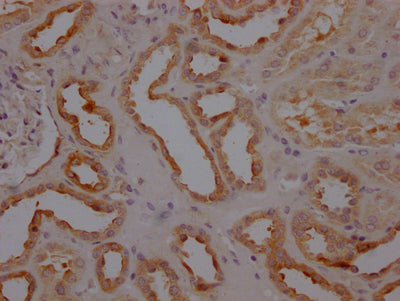 IHC image of RAC07123 diluted at 1:100 and staining in paraffin-embedded human kidney tissue performed on a Leica BondTM system. After dewaxing and hydration, antigen retrieval was mediated by high pressure in a citrate buffer (pH 6.0). Section was blocked with 10% normal goat serum 30min at RT. Then primary antibody (1% BSA) was incubated at 4? overnight. The primary is detected by a Goat anti-rabbit IgG polymer labeled by HRP and visualized using 0.05% DAB.