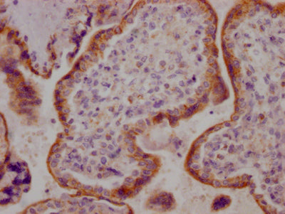 IHC image of RAC07124 diluted at 1:100 and staining in paraffin-embedded human placenta tissue performed on a Leica BondTM system. After dewaxing and hydration, antigen retrieval was mediated by high pressure in a citrate buffer (pH 6.0). Section was blocked with 10% normal goat serum 30min at RT. Then primary antibody (1% BSA) was incubated at 4? overnight. The primary is detected by a Goat anti-rabbit IgG polymer labeled by HRP and visualized using 0.05% DAB.