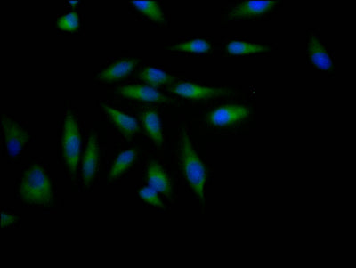 Immunofluorescence staining of Hela Cells with RAC07126 at 1:50, counter-stained with DAPI. The cells were fixed in 4% formaldehyde, permeated by 0.2% TritonX-100, and blocked in 10% normal Goat Serum. The cells were then incubated with the antibody overnight at 4?. Nuclear DNA was labeled in blue with DAPI. The secondary antibody was FITC-conjugated AffiniPure Goat Anti-Rabbit IgG (H+L).