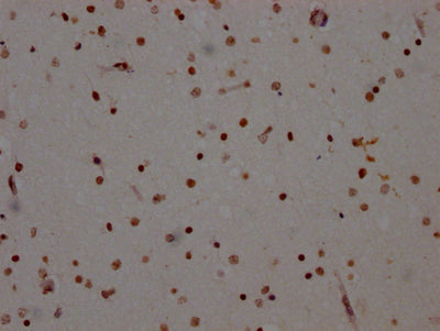 IHC image of RAC07127 diluted at 1:100 and staining in paraffin-embedded human brain tissue performed on a Leica BondTM system. After dewaxing and hydration, antigen retrieval was mediated by high pressure in a citrate buffer (pH 6.0). Section was blocked with 10% normal goat serum 30min at RT. Then primary antibody (1% BSA) was incubated at 4? overnight. The primary is detected by a Goat anti-rabbit IgG polymer labeled by HRP and visualized using 0.05% DAB.