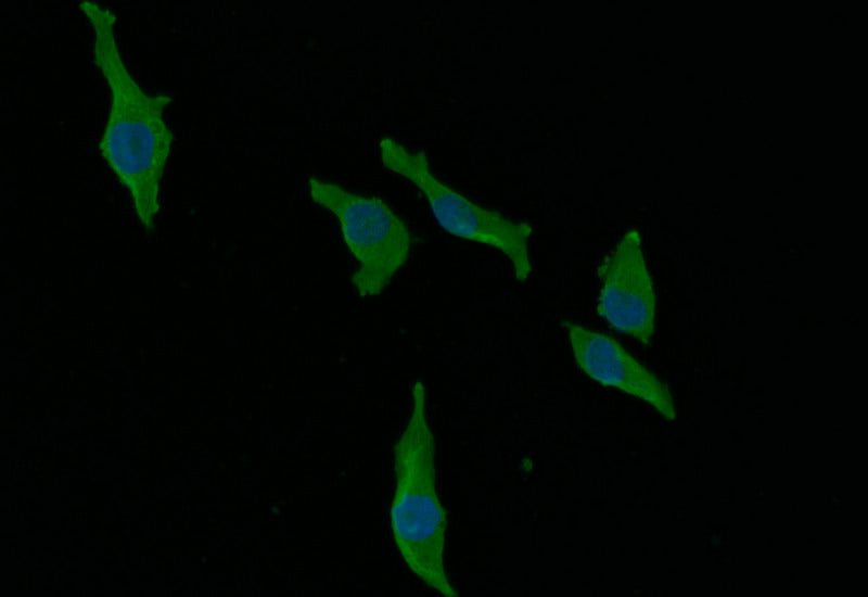 Immunofluorescence staining of MCF-7 with RAC07128 at 1:30, counter-stained with DAPI. The cells were fixed in 4% formaldehyde and blocked in 10% normal Goat Serum. The cells were then incubated with the antibody overnight at 4Â°C. The secondary antibody was Alexa Fluor 492-congugated AffiniPure Goat Anti-Rabbit IgG(H+L).